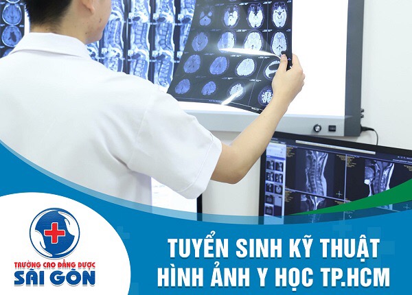 Tuyển sinh đào tạo ngành kỹ thuật chẩn đoán hình ảnh y học Sài Gòn