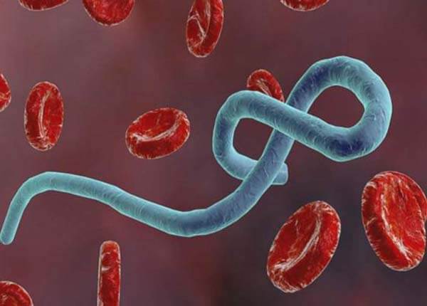 Triệu chứng và cách phòng ngừa bệnh do virus Ebola