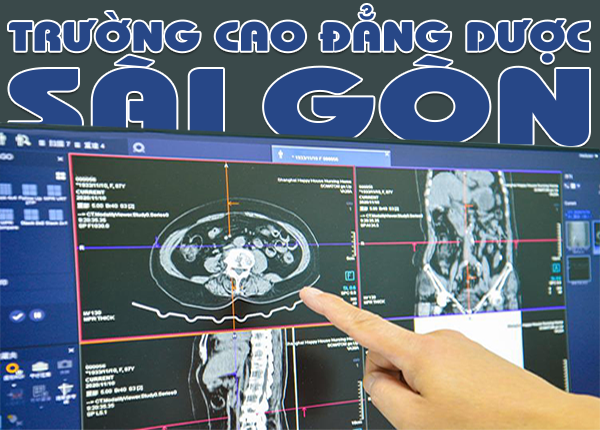 Học phí Cao đẳng ngành Kỹ thuật hình ảnh Y học Sài Gòn