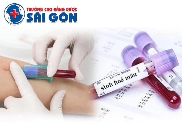 Tìm hiểu các xét nghiệm viêm gan B từ Bác sĩ Trường Dược Sài Gòn