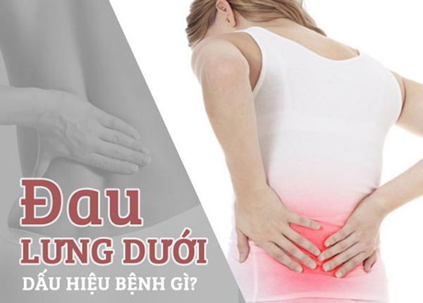 B.s Trường Dược Sài Gòn chia sẻ về tình trạng đau lưng dưới gần mông