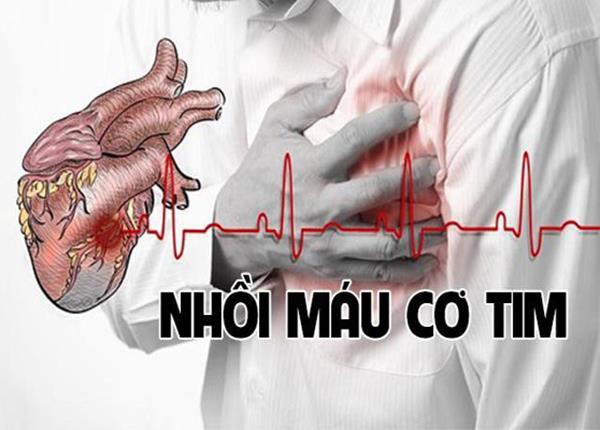 Bác sĩ Trường Dược Sài Gòn và những lưu ý về bệnh nhồi máu cơ tim