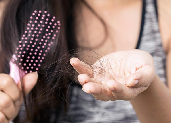 Cách nhận biết và xử lý tóc rụng nhiều do bệnh lý