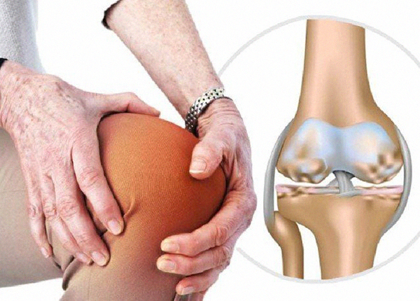 Hiểu đúng bản chất khô khớp để phòng ngừa và điều trị hiệu quả