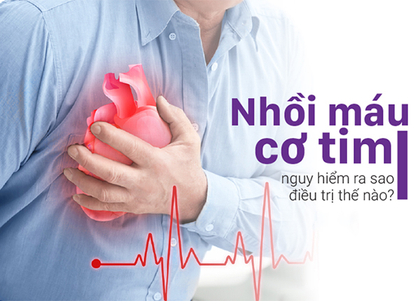 Những điều bạn cần biết về bệnh nhồi máu cơ tim cực nguy hiểm