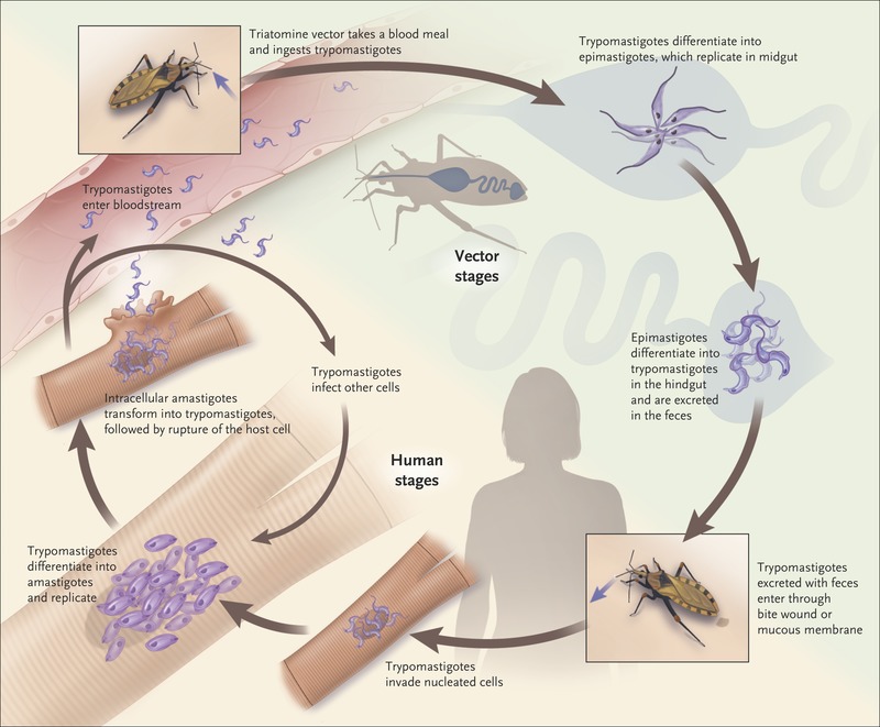 Bệnh Chagas (bệnh sán lá gan Mỹ)