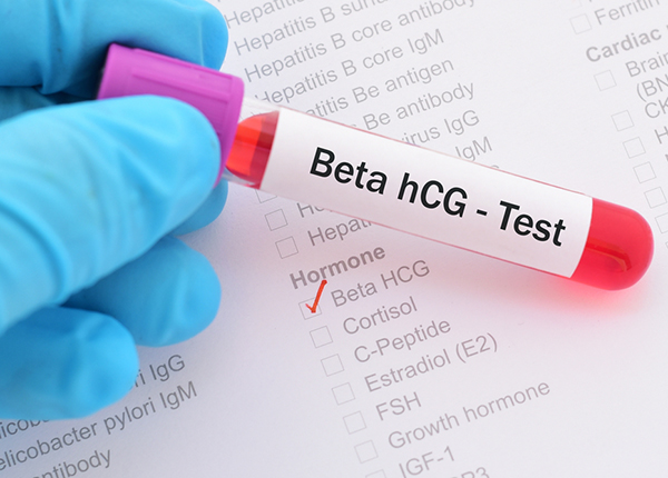 Những thông tin và ý nghĩa của xét nghiệm Beta HCG
