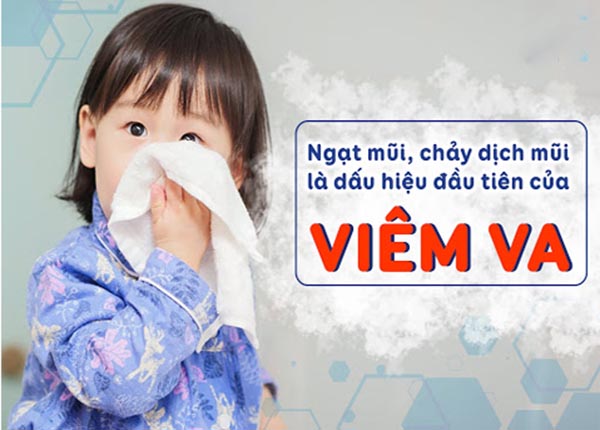 Thầy thuốc YHCT Sài Gòn chia sẻ bài thuốc trị viêm VA hiệu quả