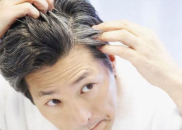 Bài thuốc trong y học cổ truyền loại bỏ râu tóc bạc sớm