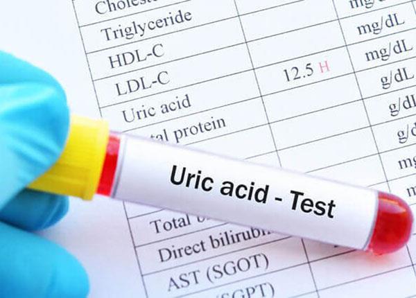 Các tác nhân chính gây tăng acid uric máu và cách điều trị
