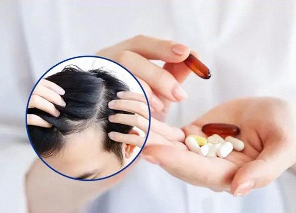 Hướng dẫn toàn diện điều trị nấm tóc bằng thuốc