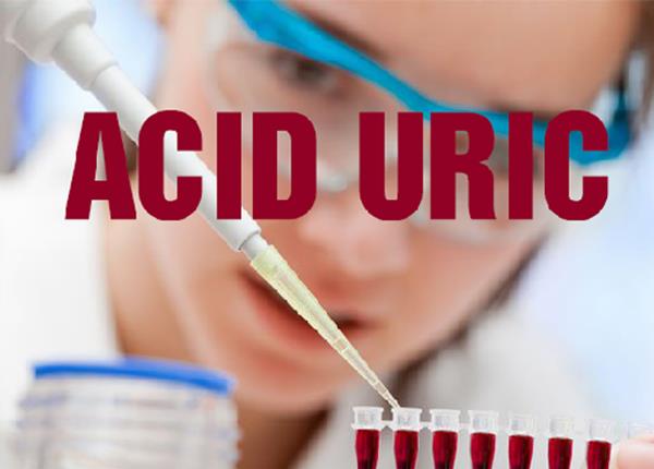 Khi nào cần thực hiện xét nghiệm acid uric?