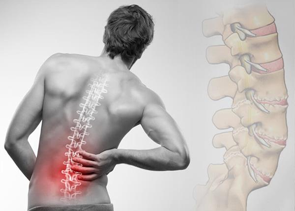 Người trẻ tuổi bị đau cột sống thắt lưng là biểu hiện của bệnh lý gì?