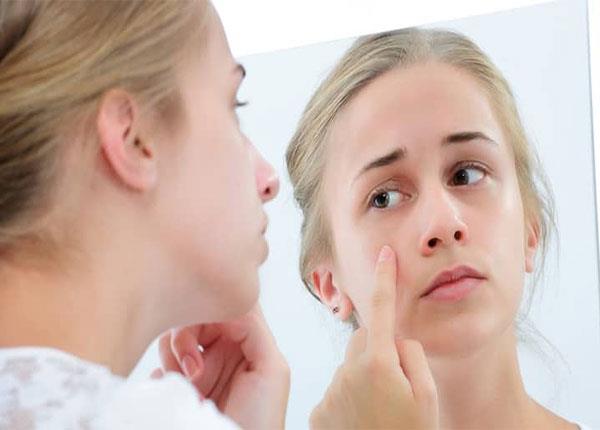 Những sai lầm trong chăm sóc da khiến da bạn ngày càng xấu đi