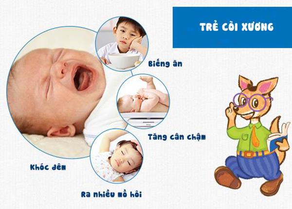 Tìm hiểu nguyên nhân và các triệu chứng nhận biết bệnh còi xương