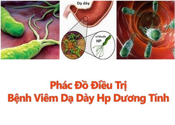 Tìm hiểu phác đồ điều trị bệnh viêm dạ dày HP dương tính