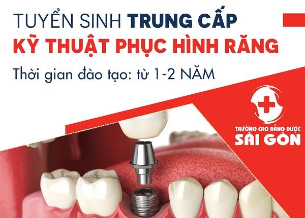Tuyển sinh Trung cấp Kỹ thuật phục hình răng Sài Gòn năm 2018