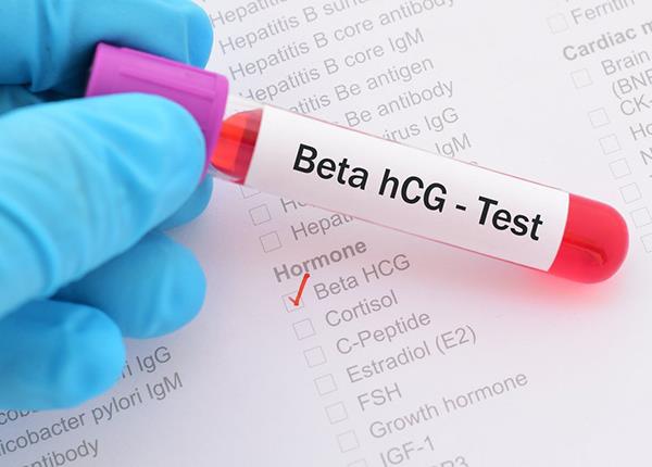 Ý nghĩa của xét nghiệm beta HCG trong chẩn đoán thai kỳ